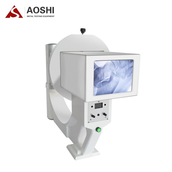 Ekstremitelerin Röntgeni